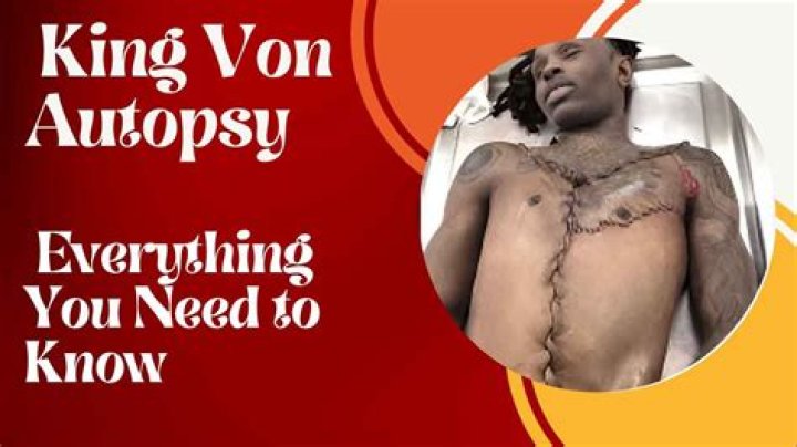 Autopsy On King Von: A Comprehensive Analysis