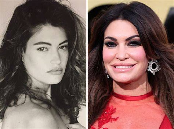 Exploring The Evolution: Kimberly Guilfoyle Before And After Images