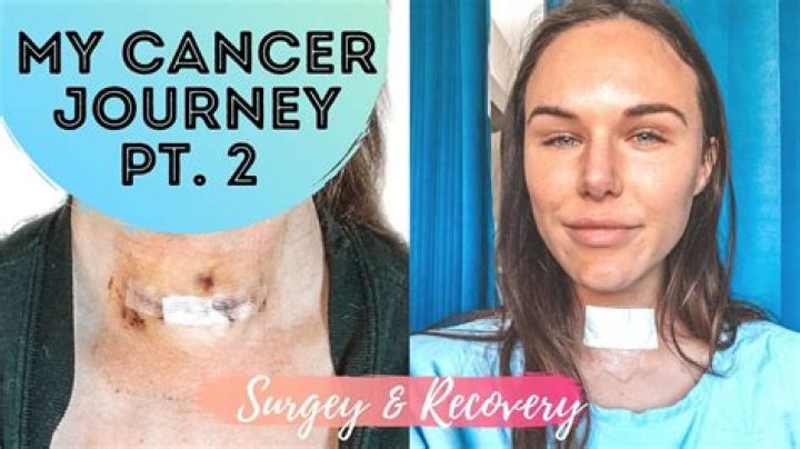 Joyce Vance: Overcoming Thyroid Surgery Challenges