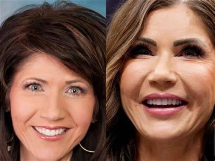 Transformative Journey: Kristi Noem Before And After